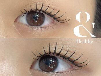 アネラ アイズ(Anela eyes)/＆healthy（アンドヘルシー）