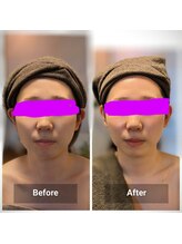 リノリー 一関店(rinory)/小顔矯正＆マッサージ＆EMS