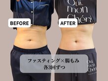 ラシーン(Racine)/