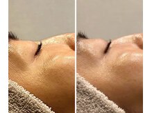 ビュウナ 銀座(BEAUNA)/シルクブライト