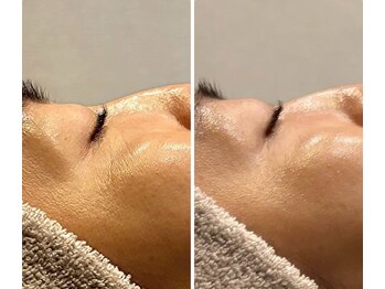 ビュウナ 銀座(BEAUNA)/シルクブライト