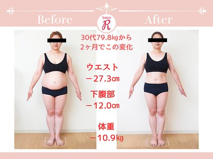 サロン アール(Salon R)の写真