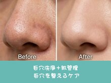 ココミエレ(COCO MIELE)/毛穴改善ビフォーアフター