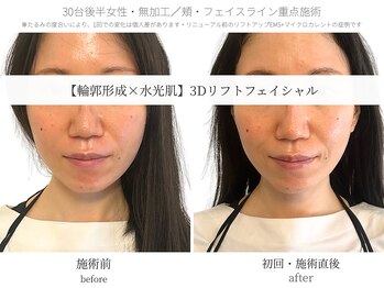 サボラミ(sabor A Mi)/フェイスラインのゆるみに◎