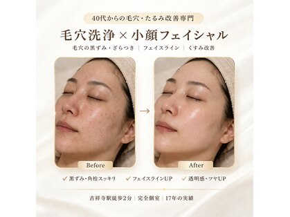 エービューティー(A Beauty)の写真