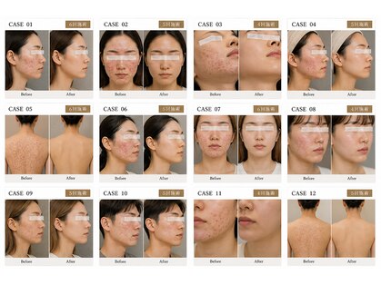 ホクビューティー(HOCU BEAUTY)の写真