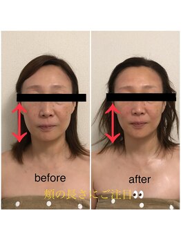 ココ(coco)/モニター限定メニュー☆