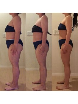 ホロニック ベルサンテ(Holonic Belle Sante)/メディセルハイブリッド