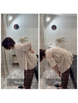 ナオル整体 広島福山院(NAORU整体)/腰痛/前屈の痛み→Before/After