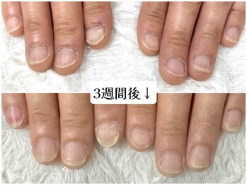 グレースレディ 神戸北店/