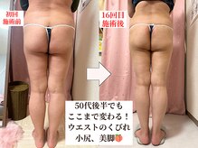 ピーチ(Peach)の雰囲気(全身矯正×下半身痩身ダイエット 16回施術ビフォーアフター)