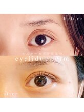 アプレ(APPELER)/アイリッドアップパーマ