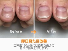 レアム/ご来店当日から見た目改善