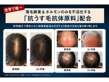 アミティ プラス(amity plus)の雰囲気(抗体スカルプケア+極上ヘッドマッサージでお悩みケア リラックス)
