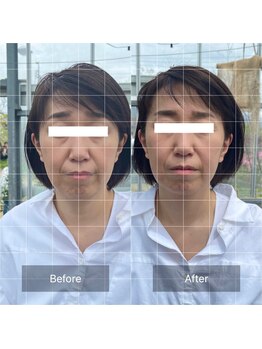 フフラ KANコルギセラピー山梨本店(fufla)/小顔ソムリエ　