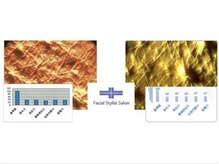 フェイシャルスタイリストサロン 四谷店/ケア例（62）