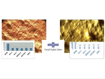 フェイシャルスタイリストサロン 四谷店/ケア例(62)