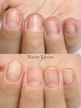マリーロール 梅田店(Marie Laure)/自爪育成/深爪矯正/ネイルケア