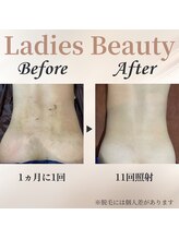 シャーロック(4869Sherlock)/背中BeforeAfter