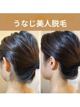 ティンクルホワイト 上尾店/うなじ脱毛