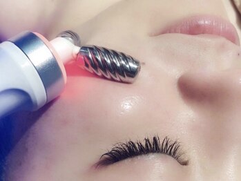 リーチェ ビューティアンドネイルサロン 大名店(Beauty&Nail Salon)/イオン導入の約20倍!