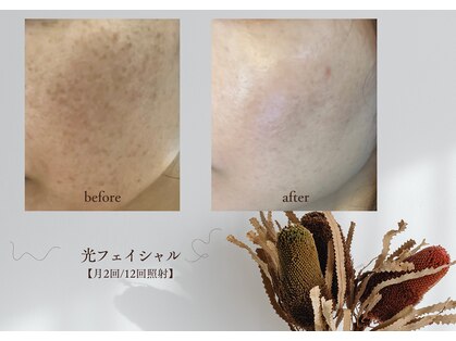 サニーサイド(Sunny side)の写真