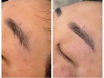 エムズハグ(M's hug)/眉毛ワックス/20代/下がり眉悩み