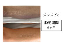 メンズビオ 神戸三宮店/