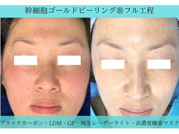 リメイククリニカルビューティー(Remake clinical beauty)/