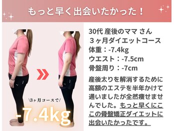 なかしま鍼灸整骨院/30代産後ママさん（痩身/骨盤）