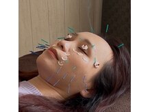 彩花の雰囲気（眠れる鍼。ゆるめて、深く眠る刺激が苦手な方にもおすすめです）