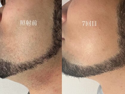 ステラ(STELLA)の写真