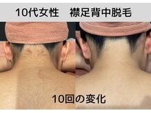 ビモア(Bmore)/★ビフォーアフター★