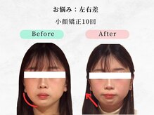 ウェリナ 一宮院/小顔矯正/骨盤矯正/痩身整体