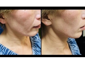 サロンモコ(Salon Moco)の写真/【40・50代】小じわや年齢肌のお悩みに寄り添う丁寧な施術☆潤いを与えてふっくらとしたなめらかな素肌へ
