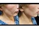 サロンモコ(Salon Moco)の写真/【40・50代】小じわや年齢肌のお悩みに寄り添う丁寧な施術☆潤いを与えてふっくらとしたなめらかな素肌へ