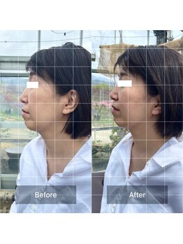 フフラ KANコルギセラピー山梨本店(fufla)/小顔ソムリエ　小顔