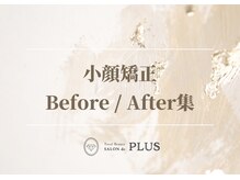 ボディのココチ 品川店(ボディのCOCOCHI)/【 #小顔矯正 】Before/After
