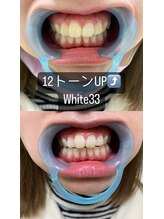 アイブロウ33/ホワイトニング　