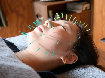 マヒナラボ 湘南(Mahina.lab)/美容鍼灸