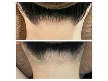 ミース 原宿店の雰囲気（《うなじビフォーアフター》綺麗なうなじでアップヘアに自信♪）