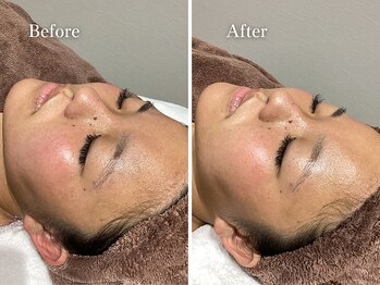 エリー(Ellie)/シェービングへのこだわり