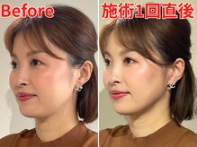 フローフシ∞
