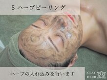 ヴィキ 北千住(VIKI)/STEP5 ハーブピーリング入れ込み