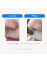 ムーンライズ(moonrise)/