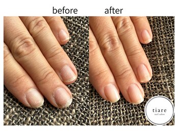 ティアレ(tiare)/ビフォーアフター