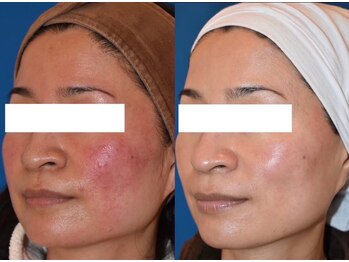 サローネファミリア(SALONE FAMILIA)/敏感肌もご覧の通り