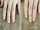 自爪育成ケア 8ヶ月の成果