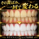 ホワイトニングショップ 山科店