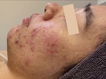 ウェクシー(WECXII)/